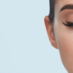 Blepharoplasty/Eyelid surgery