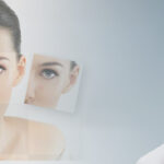 FRACTIONAL CO2 LASER